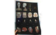 医用激光打印胶片